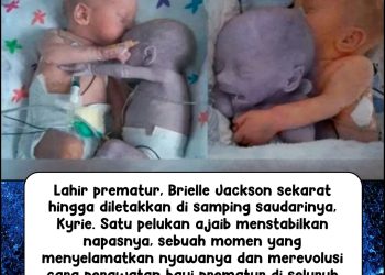 Pelukan Ajaib The ‘Rescuing Hug’ Menyelamatkan Nyawa dan Mengubah Dunia Kedokteran